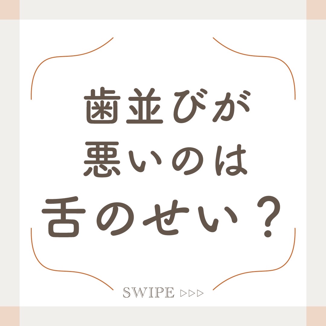 歯並びが悪いのは舌のせいかも？